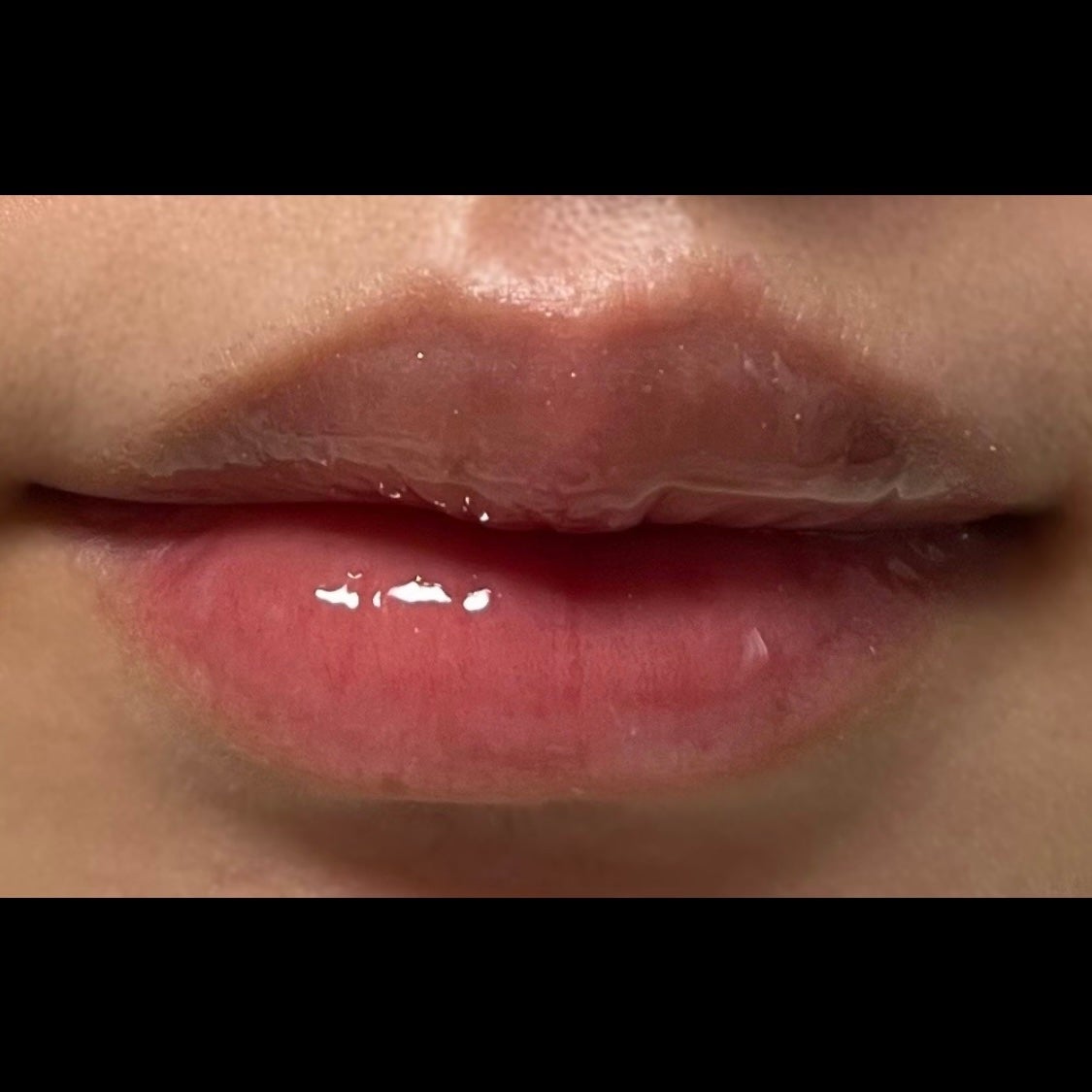 ガラスプランパー/CipiCipi/リッププランパーを使ったクチコミ(5枚目)