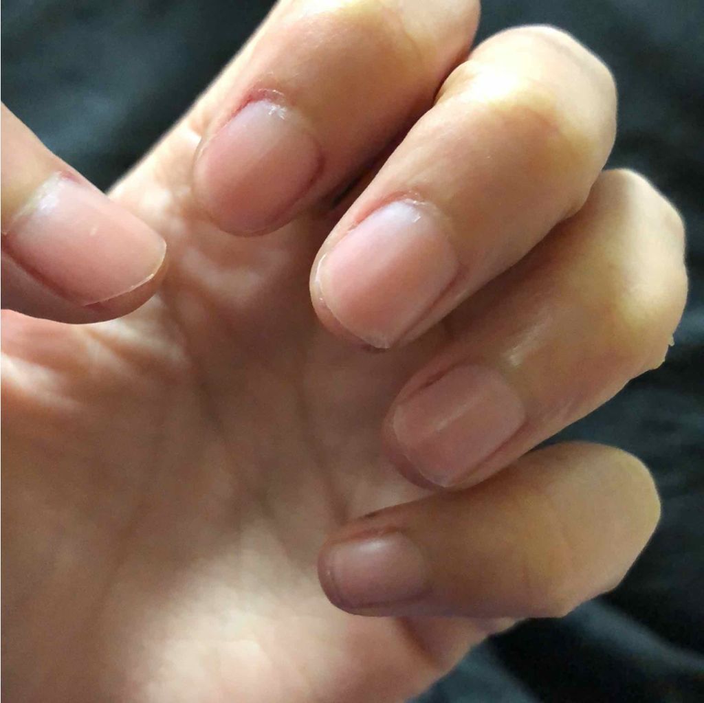 LJ ネイルリムーバーシート/LOUJENE/除光液を使ったクチコミ(3枚目)