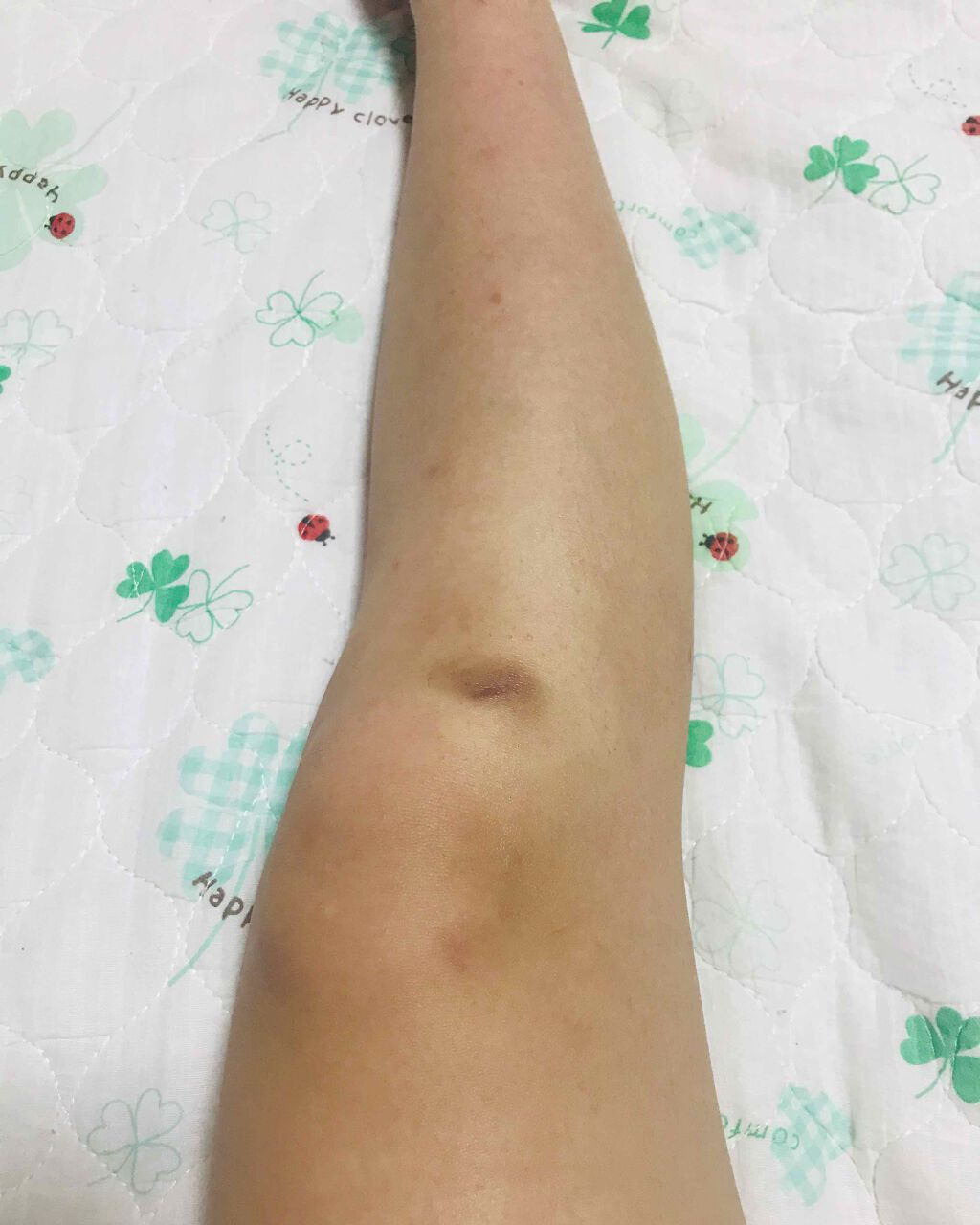 ニベアクリーム/ニベア/ボディクリームを使ったクチコミ（3枚目）