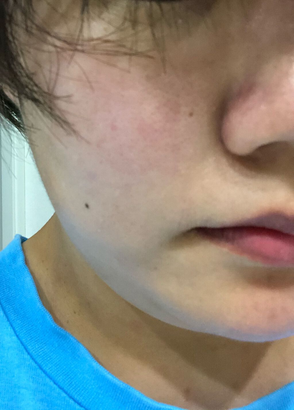 デュイセル シカプラスバーム/DEWYCEL/フェイスクリームを使ったクチコミ（2枚目）