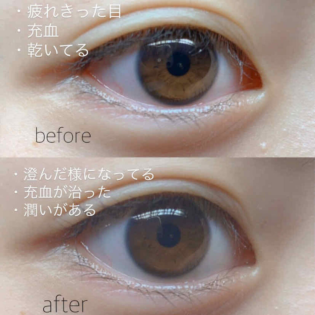 スマイルホワイティエ(医薬品)/ライオン/その他を使ったクチコミ（2枚目）