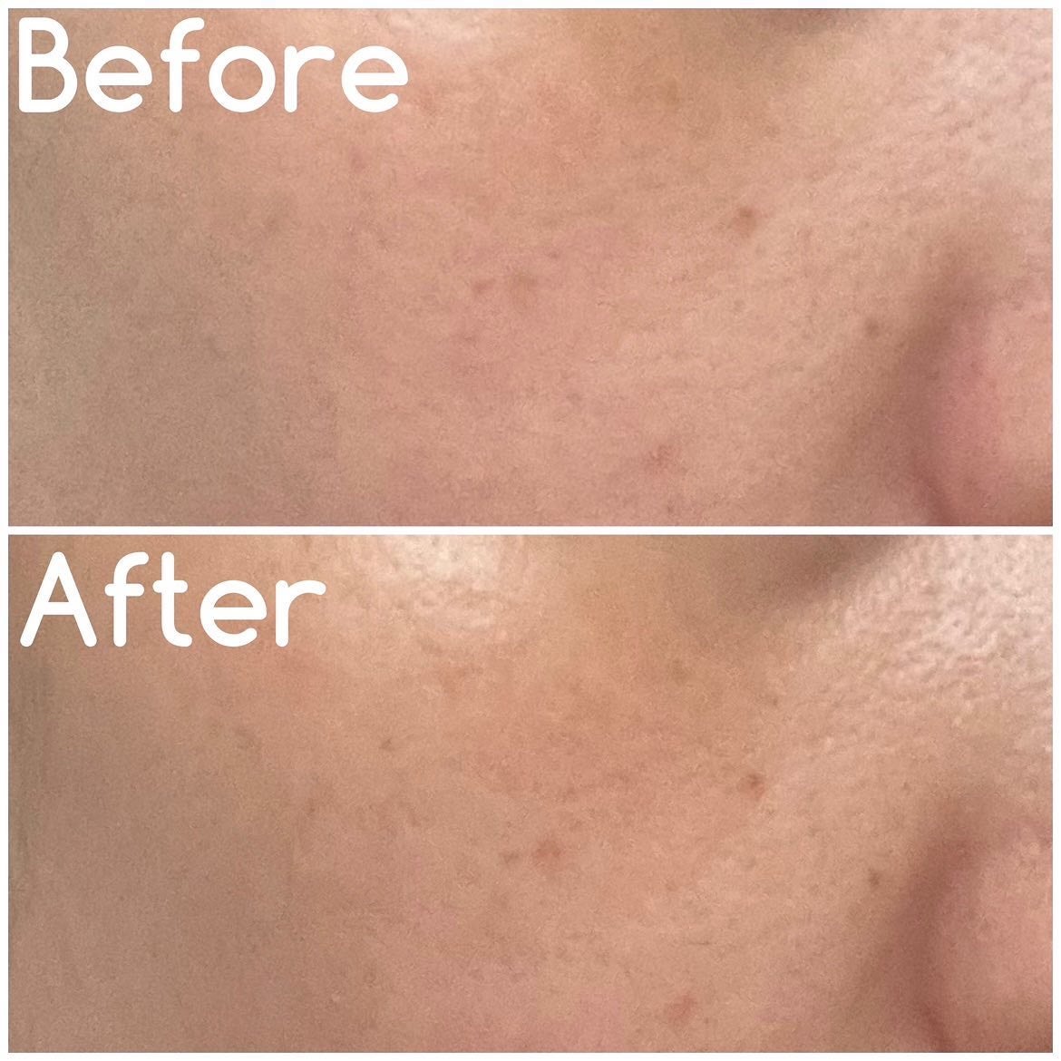 HIK ミスト/HIK/ミスト状化粧水を使ったクチコミ(4枚目)