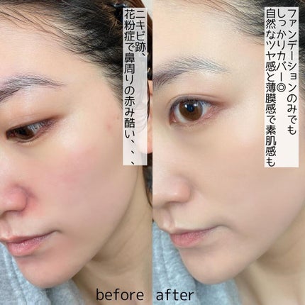 ムーヴフィットファンデーション/LB/リキッドファンデーションを使ったクチコミ(4枚目)