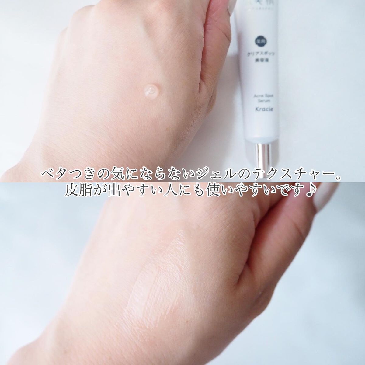 大人のニキビ対策 薬用クリアスポッツ美容液 /肌美精/美容液を使ったクチコミ（3枚目）