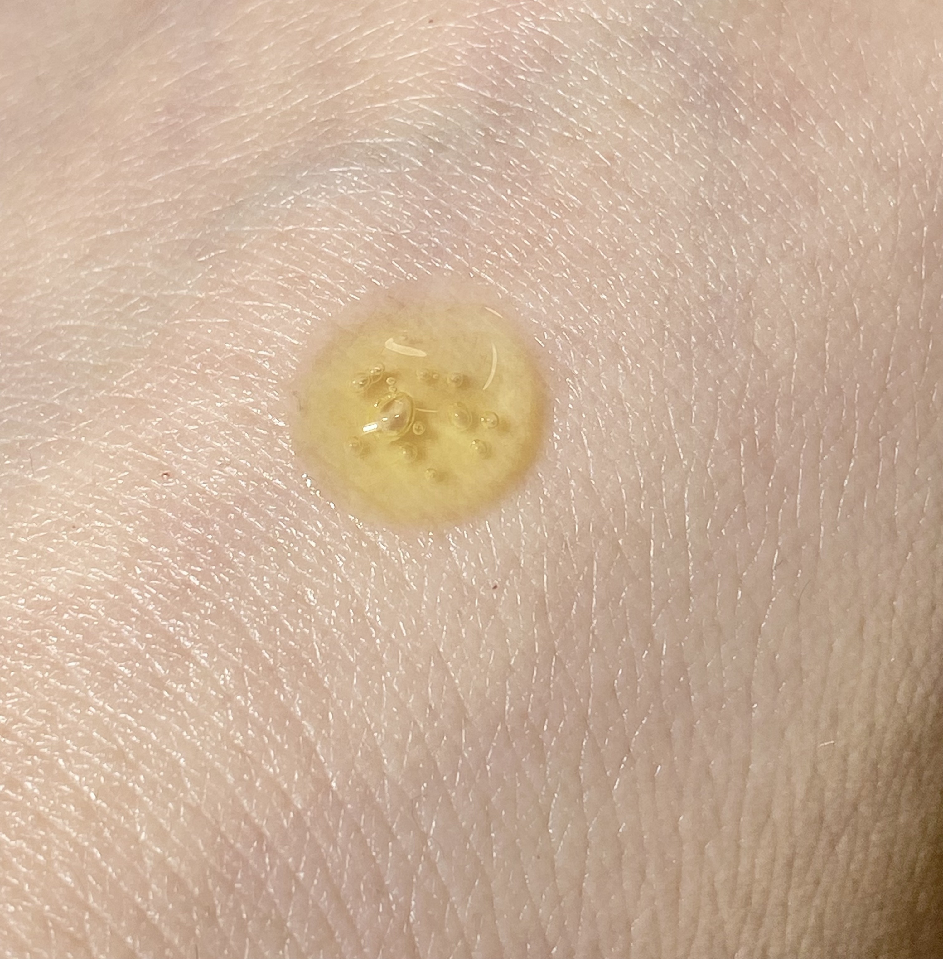 Sensitive Soothing Gel Cream/MARY&MAY/フェイスクリームを使ったクチコミ（3枚目）