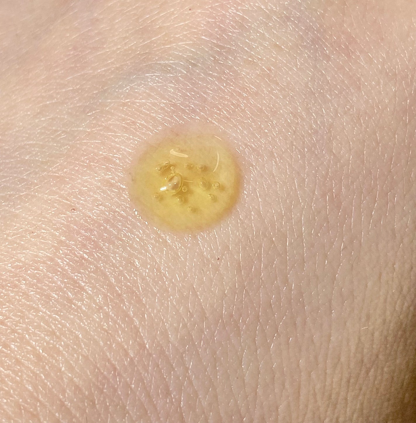 Idebenone+Blackberry complex serum/MARY&MAY/美容液を使ったクチコミ(3枚目)