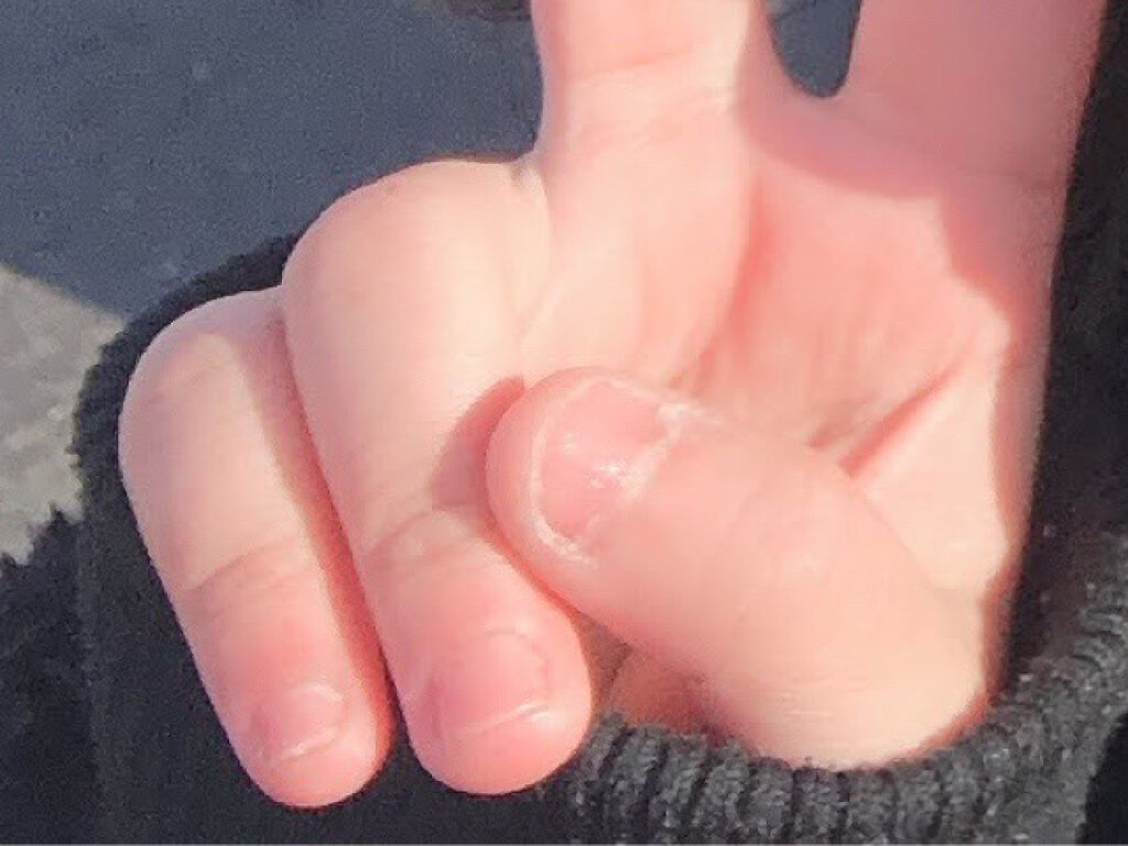 ハンドベール プレミアムリッチネイル/メンソレータム/ネイルオイル・トリートメントを使ったクチコミ(2枚目)