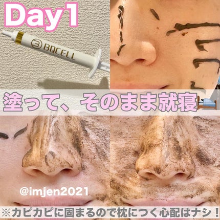 ダーマスキンピーリング/BQCELL/その他キットセットを使ったクチコミ(4枚目)