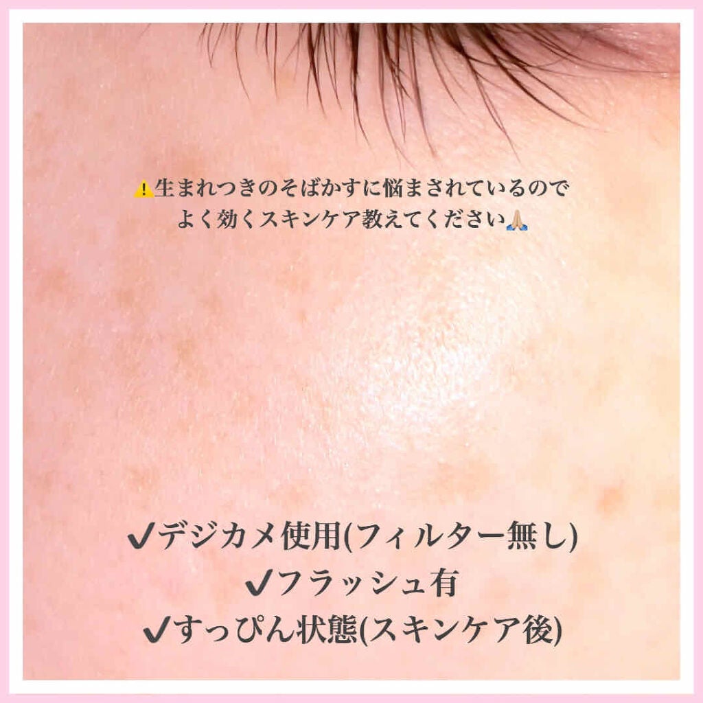 天然こんにゃくパフ/DAISO/その他スキンケアグッズを使ったクチコミ(2枚目)