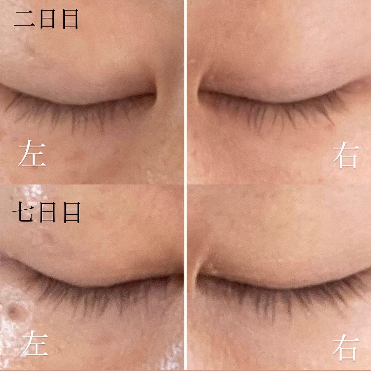 24アイミスト/24Aqua beauty/ミスト状化粧水を使ったクチコミ(5枚目)