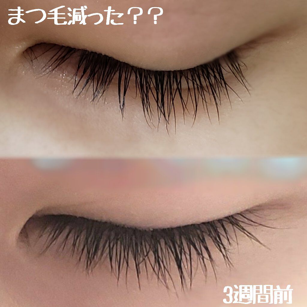 まつげ美容液EX/CEZANNE/まつげ美容液を使ったクチコミ(2枚目)