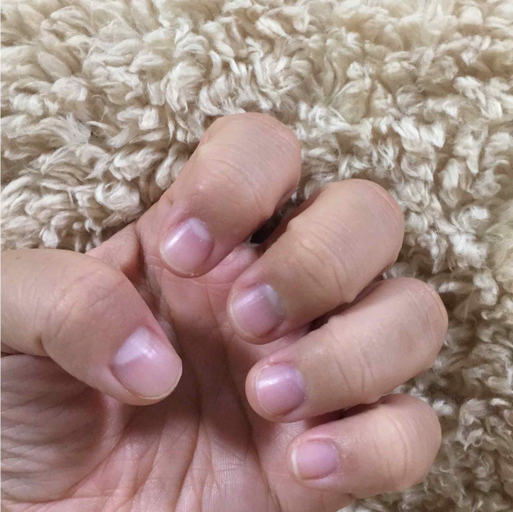 ふぁーむ on LIPS 「お久しぶりです!爪噛み克服投稿またしてきます!左手は最近爪が伸..」(1枚目)