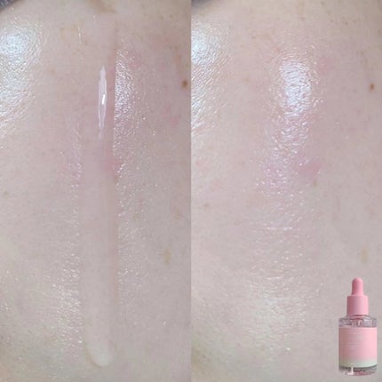 ピンクアロエムチンセラム/APRILSKIN/美容液を使ったクチコミ(4枚目)