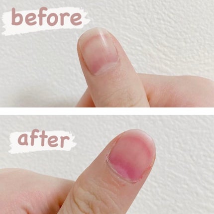 イノーチェ ネイルティント/ナリスアップ/ネイルオイル・トリートメントを使ったクチコミ(5枚目)