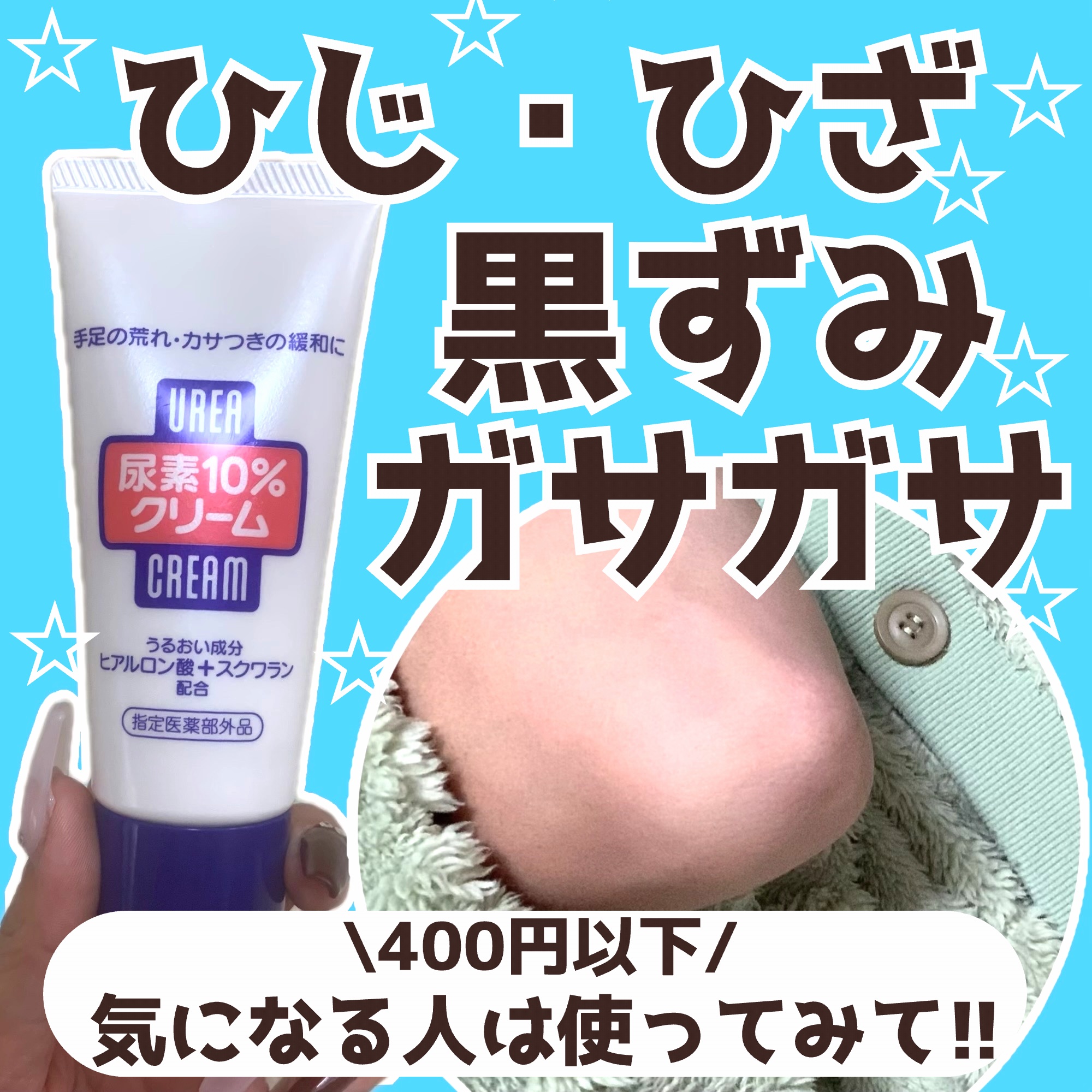 尿素10%クリーム チューブタイプ 60g/ハンド・尿素シリーズ/ハンドクリームを使ったクチコミ（1枚目）