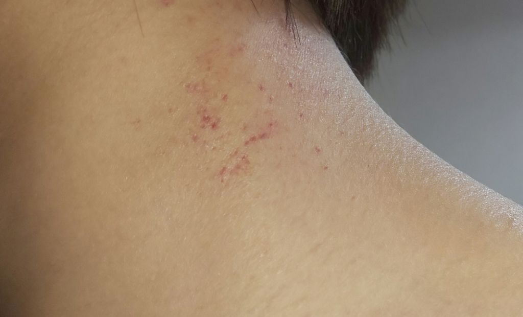 ネコかっさ/セリア/かっさプレートを使ったクチコミ（2枚目）