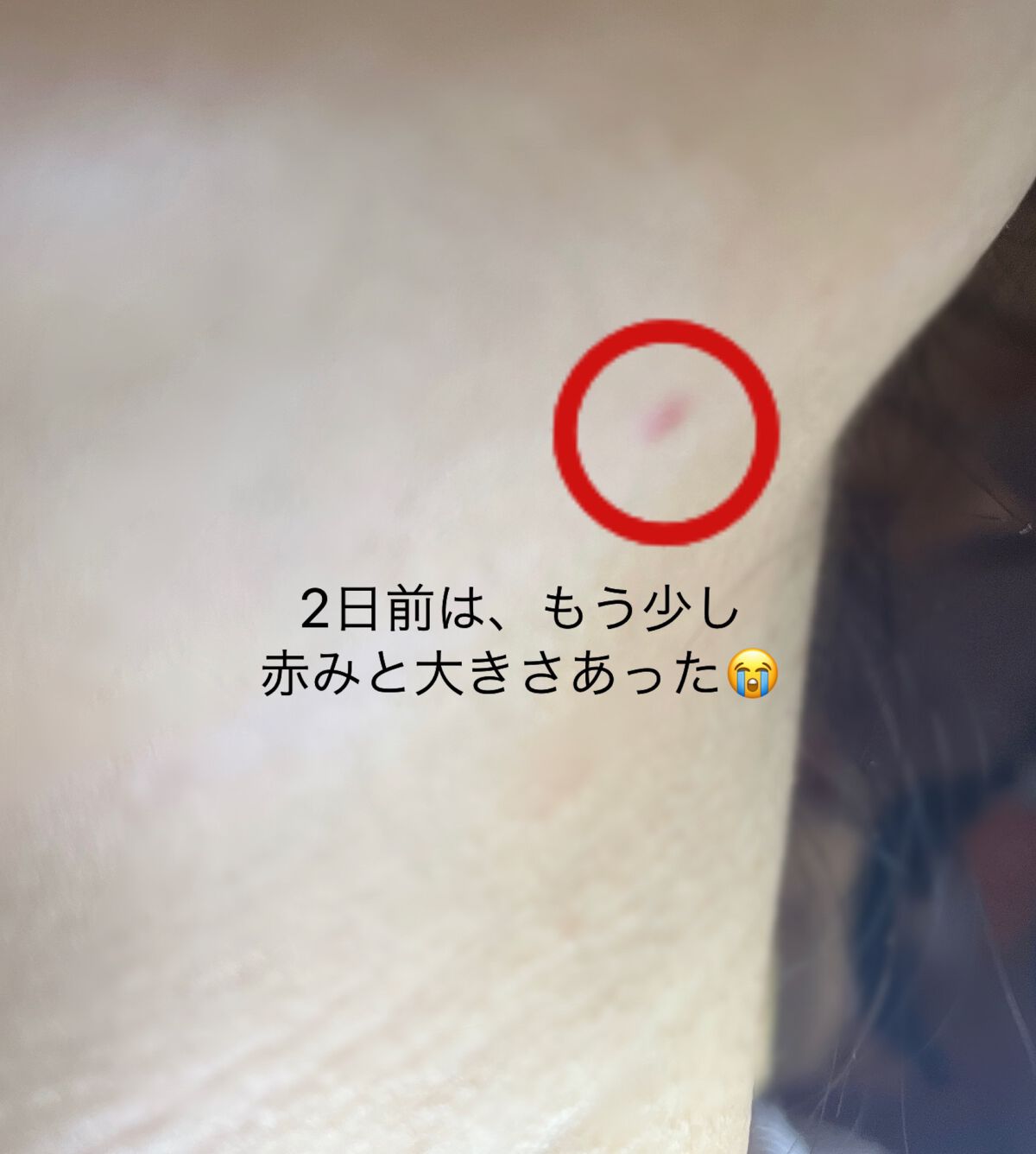 ã²ãŒð¶ð§¡ on LIPS ãâãªã«ãã¹ã®ã¯ãªã¢ã¢ã¯ãã¹ãããâããããå¹ãåºç©ã«å¡ããšå³å¹..ãïŒ4æç®ïŒ