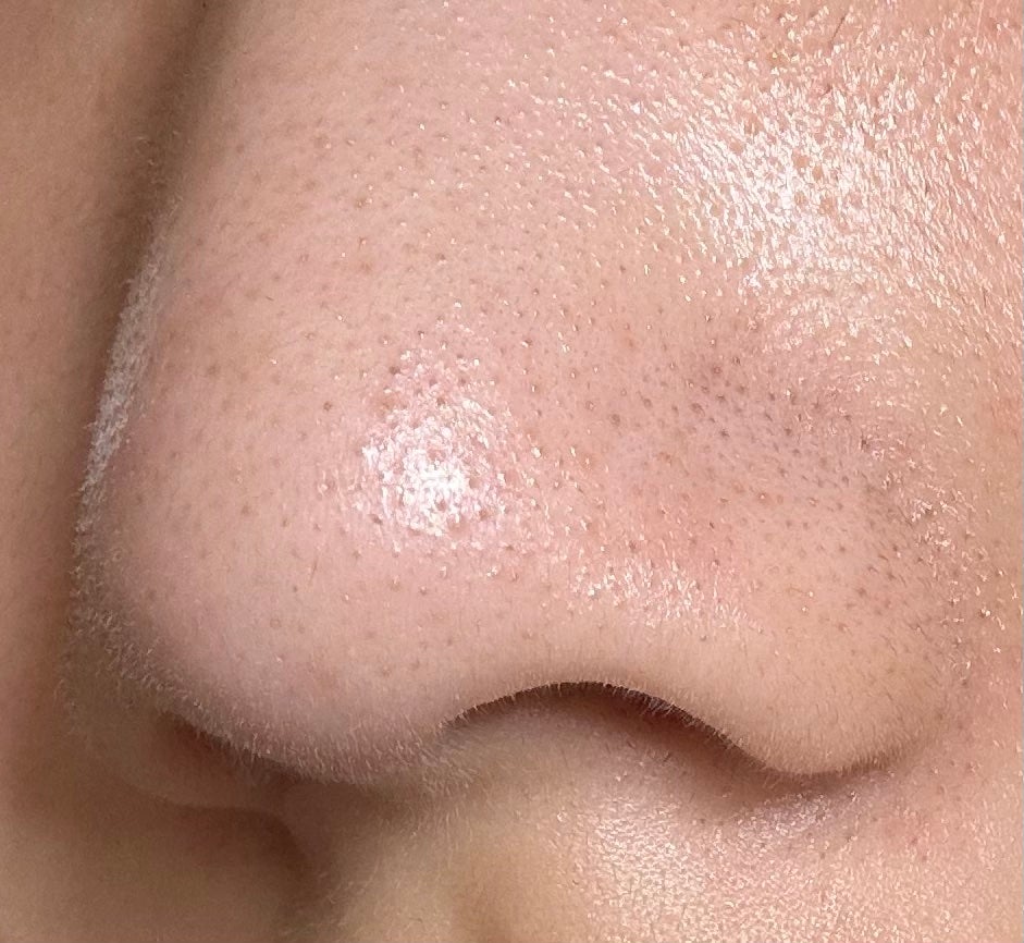 よんちょる on LIPS 「割とガチめに助けてください。最近スキンケアとかサボってたりして..」(2枚目)