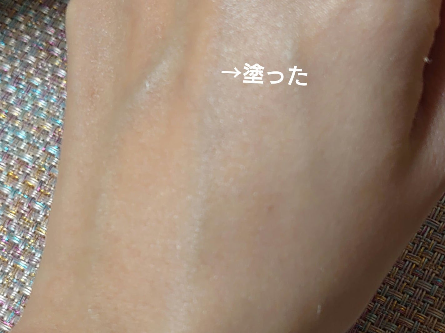 ããã³ ã¢ããã¢ã€ã¹ã ãšã€ãžã³ã°ã±ã¢ ãã€ã¯ãªãŒã UV/ããã³/æ¥çŒãæ¢ãã¯ãªãŒã ã䜿ã£ãã¯ãã³ãïŒ4æç®ïŒ