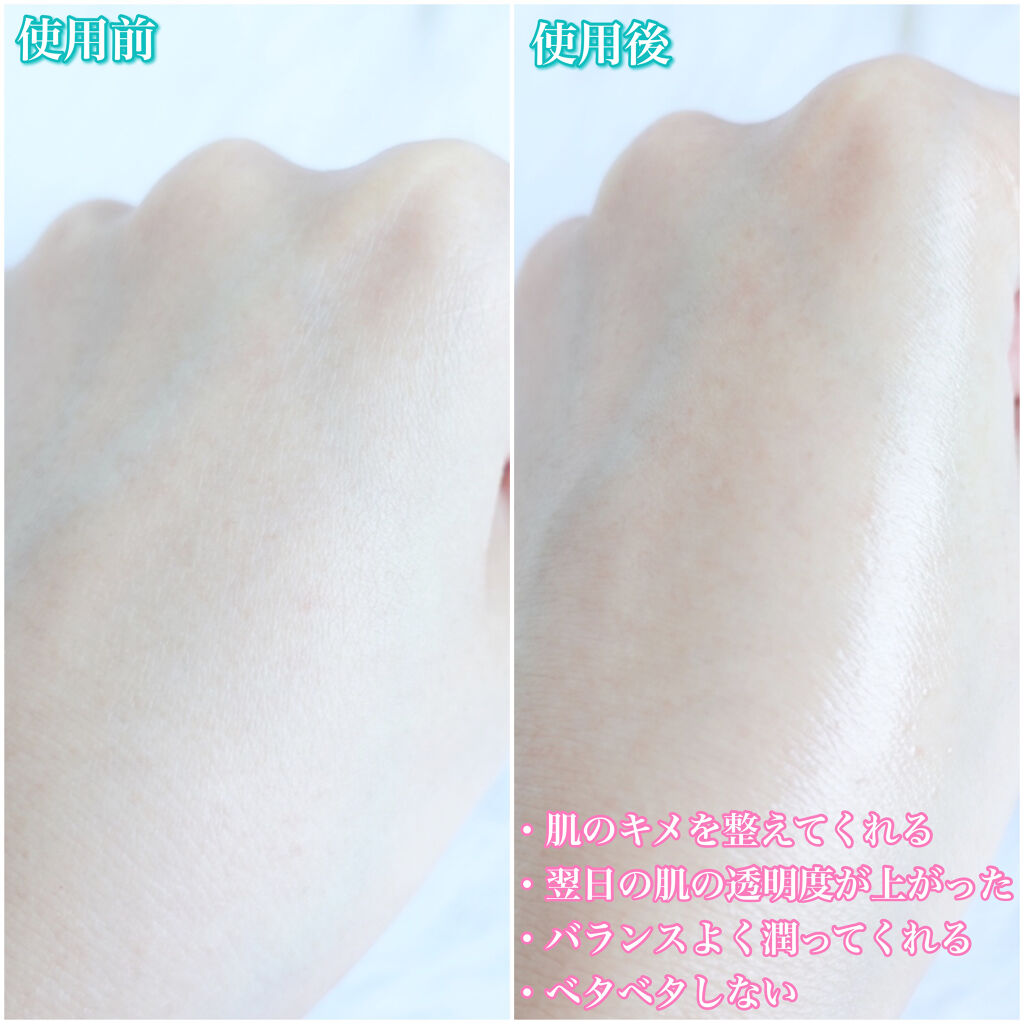 クラリフィック デュアル エッセンス ローション/LANCOME/化粧水を使ったクチコミ（3枚目）