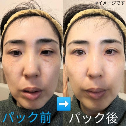 ルルルンOVER45 アイリスブルー(クリア)/ルルルン/シートマスク・パックを使ったクチコミ(3枚目)