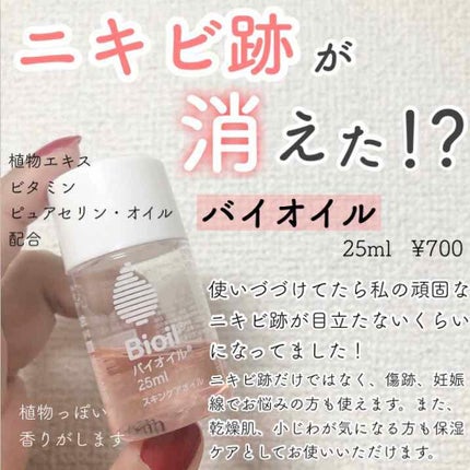 バイオイル/バイオイル/フェイスオイルを使ったクチコミ(1枚目)