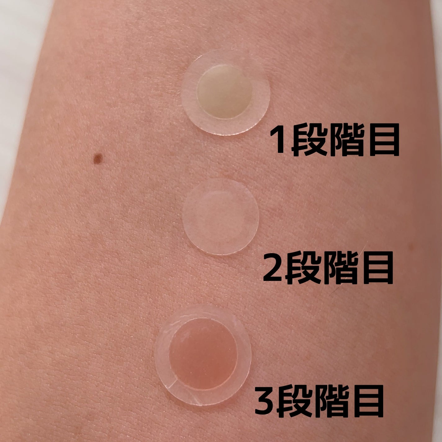 スポットイレイザー/NOLAHOUR/その他スキンケアを使ったクチコミ(5枚目)