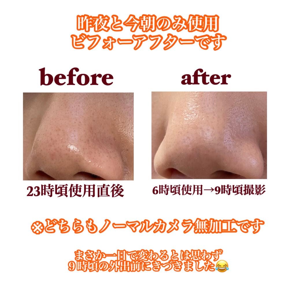 スーパー毛穴ピールセラム/ラボラボ/美容液を使ったクチコミ(2枚目)