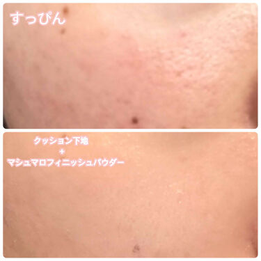 限定化粧下地 M クッションベース ミント Misshaの口コミ 肌荒れ画像あり ミシャからシカ配 By さやりんご 脂性肌 代前半 Lips