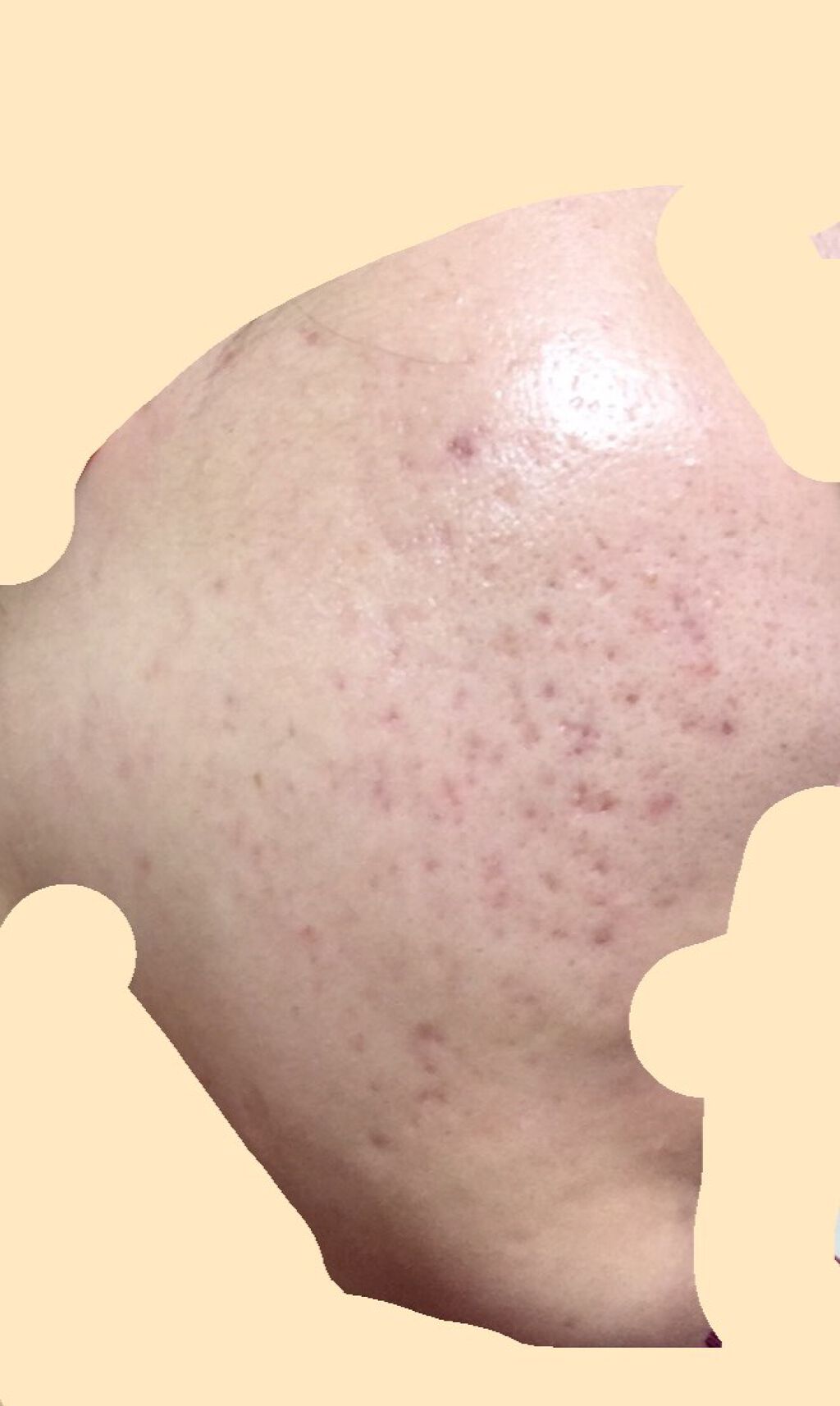 白潤 薬用美白化粧水/肌ラボ/化粧水を使ったクチコミ(3枚目)