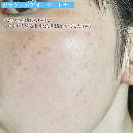 サミュ ガラクトポア セラム/SAM'U/美容液を使ったクチコミ(6枚目)