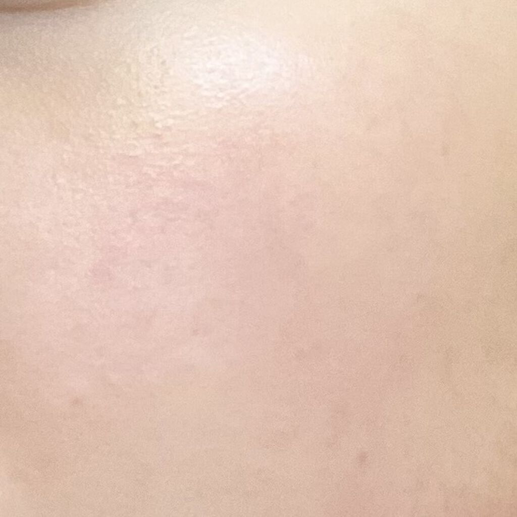 ピンクティーツリートナー/APLIN/化粧水を使ったクチコミ（3枚目）