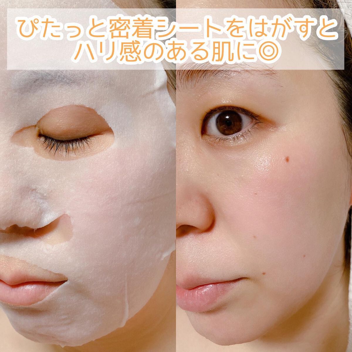 ルルルン ハイドラ V マスク/ルルルン/シートマスク・パックを使ったクチコミ（2枚目）