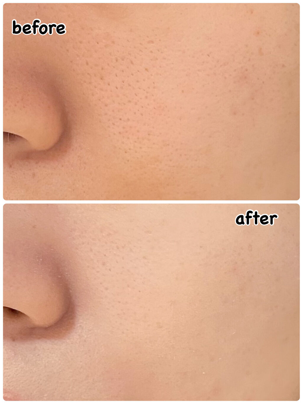 ブラック クッション/HERA/クッションファンデーションを使ったクチコミ（2枚目）