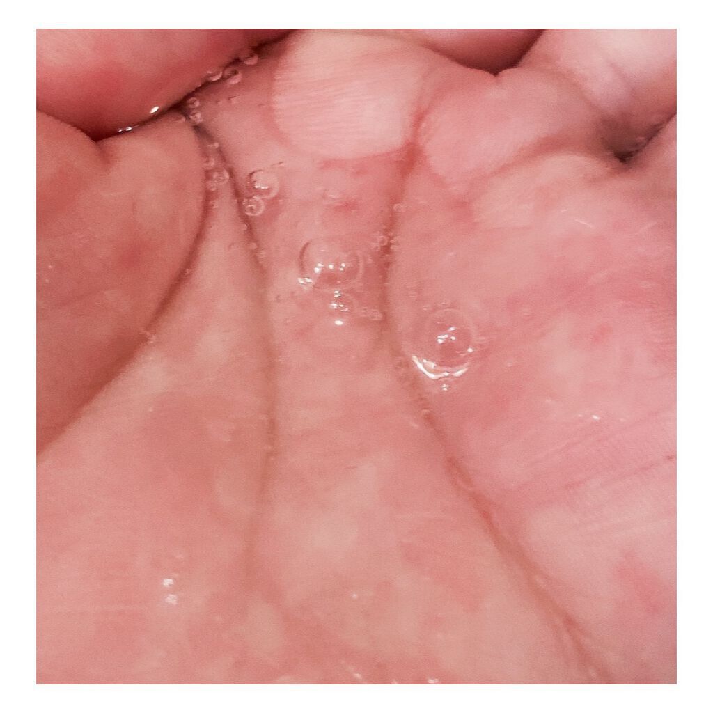 トータルリヴァイタライズ マスク/アテニア/シートマスク・パックを使ったクチコミ(5枚目)