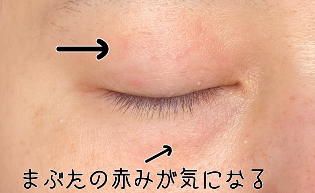 CICA クリーム/VT/フェイスクリームを使ったクチコミ（2枚目）