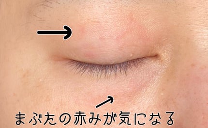 ヒアテノール アンプル/ネイチャーリパブリック/美容液を使ったクチコミ(2枚目)
