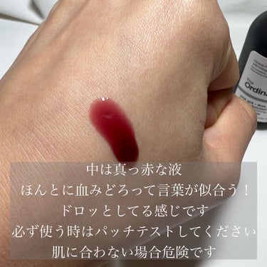 The Ordinary AHA 30% + BHA 2% Peeling Solutionのクチコミ「\注意が必要？血みどろピーリング💉/

ーーーーーーーーーーーーーーーーーーーーー
こんにちは.....」（2枚目）