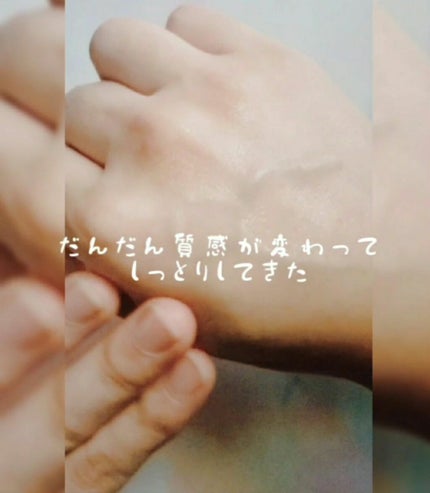 モイストバランス ローション/ACSEINE/化粧水を使ったクチコミ(3枚目)