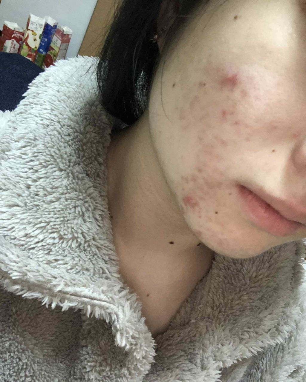 マンスリースキンケアプログラム(旧)/APEX/スキンケアキットを使ったクチコミ(4枚目)