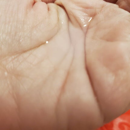 薬用化粧水/スキンライフ/化粧水を使ったクチコミ(3枚目)