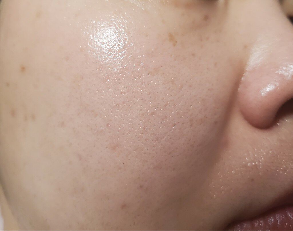 スキンコンディショナー ノーマルタイプ/ルナメアAC/化粧水を使ったクチコミ(2枚目)