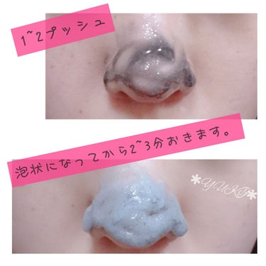 JUSO KURO PACK/NAKUNA-RE/洗い流すパック・マスクを使ったクチコミ（4枚目）