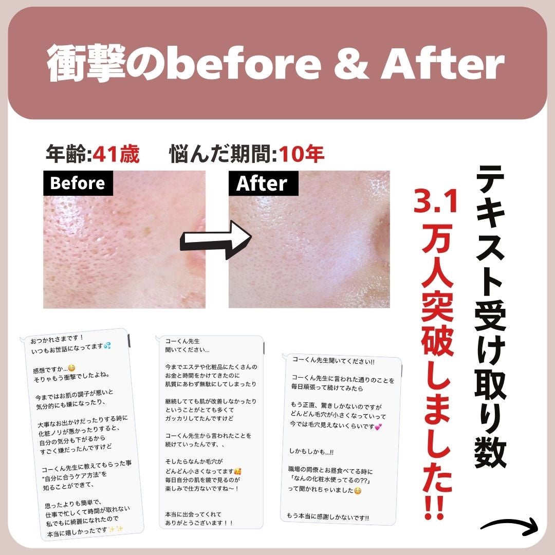 あなたの肌に合ったスキンケア💐コーくん先生 on LIPS 「【9割が知らない】コレしてる人は毛穴の開き一生消えません。....」(7枚目)