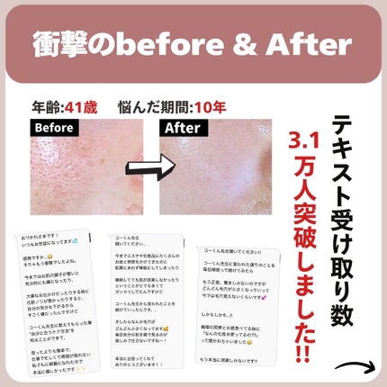 あなたの肌に合ったスキンケア💐コーくん先生 on LIPS 「【9割が知らない】コレしてる人は毛穴の開き一生消えません。....」(7枚目)