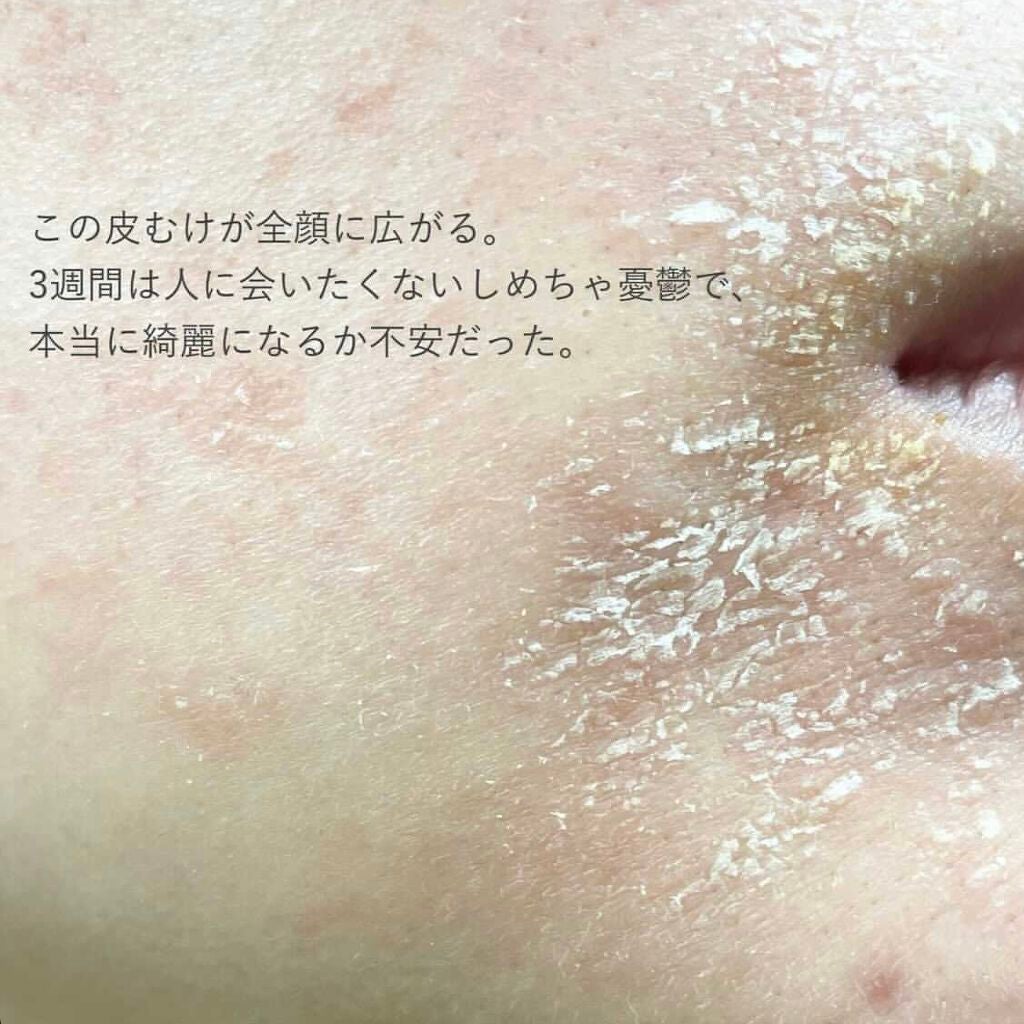 ミラミックス/ZO Skin Health/フェイスクリームを使ったクチコミ(6枚目)
