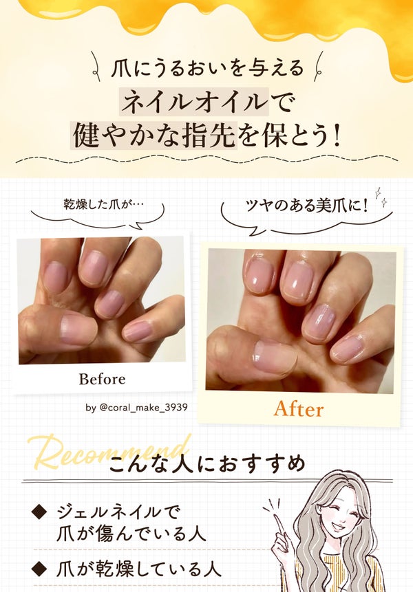 爪にうるおいを与えるネイルオイルで健やかな指先を保とう!乾燥した爪がツヤのある美爪に!ジェルネイルで爪が傷んでいる人や爪が乾燥している人におすすめ。