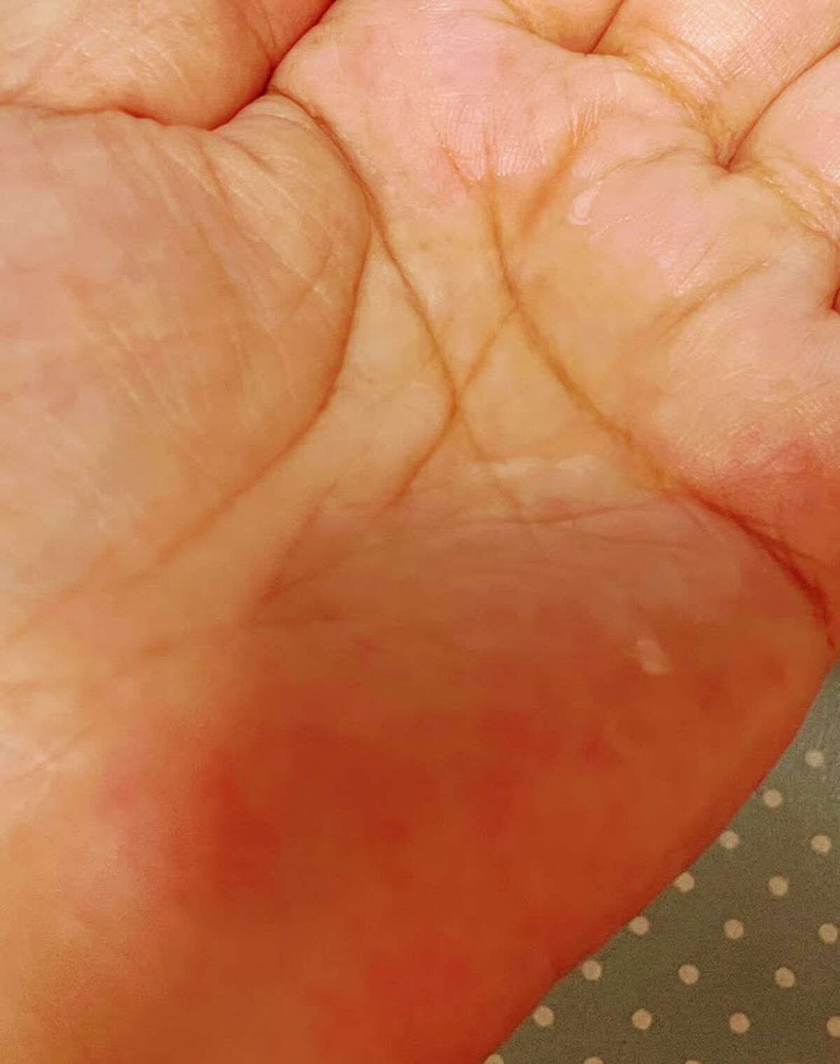 肌潤化粧水/米肌/化粧水を使ったクチコミ（1枚目）