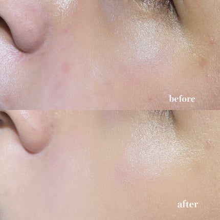 ディオールスキン フォーエヴァー フルイド グロウ/Dior/リキッドファンデーションを使ったクチコミ(3枚目)