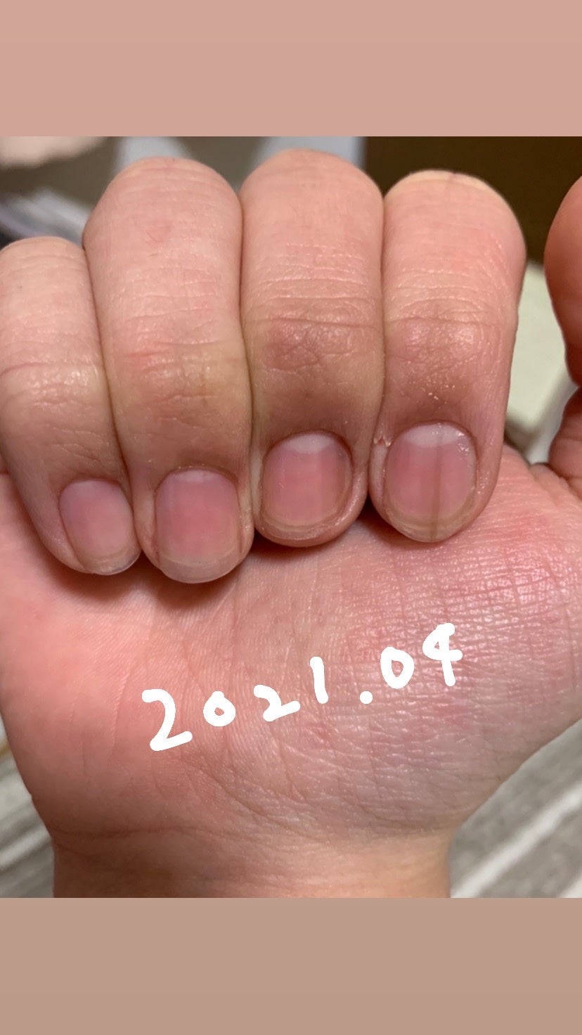 エテュセ クイックケアコート/ettusais/ネイルオイル・トリートメントを使ったクチコミ(3枚目)